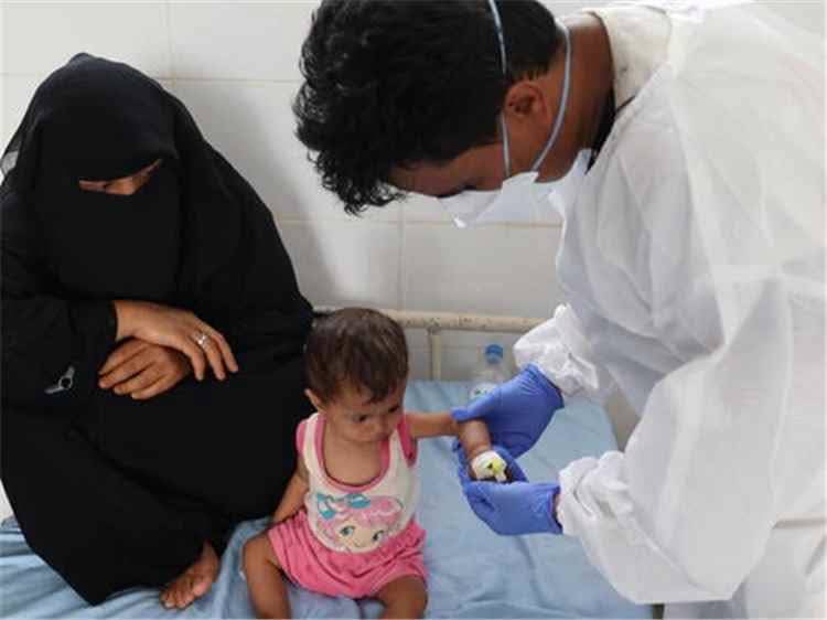 ارتفاع وفيات الحصبة في المناطق المحررة إلى 87 طفلا منذ بداية العام الجاري